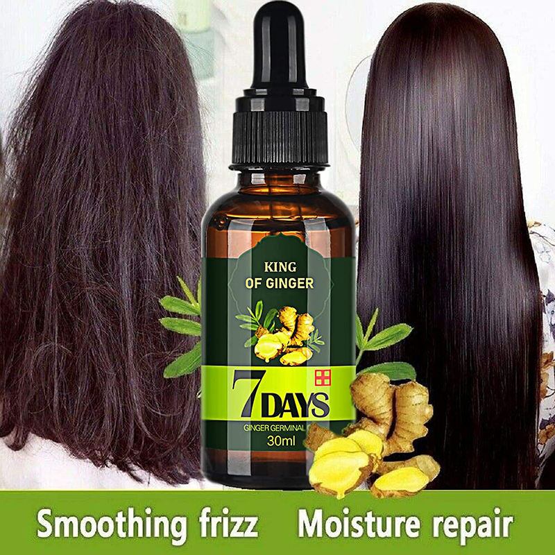 30ml 7-day Ginger Hair Growth Essence Oil for Men and Women Hair Care Repair Growth Faster and Prevents Hair Loss King of Ginger