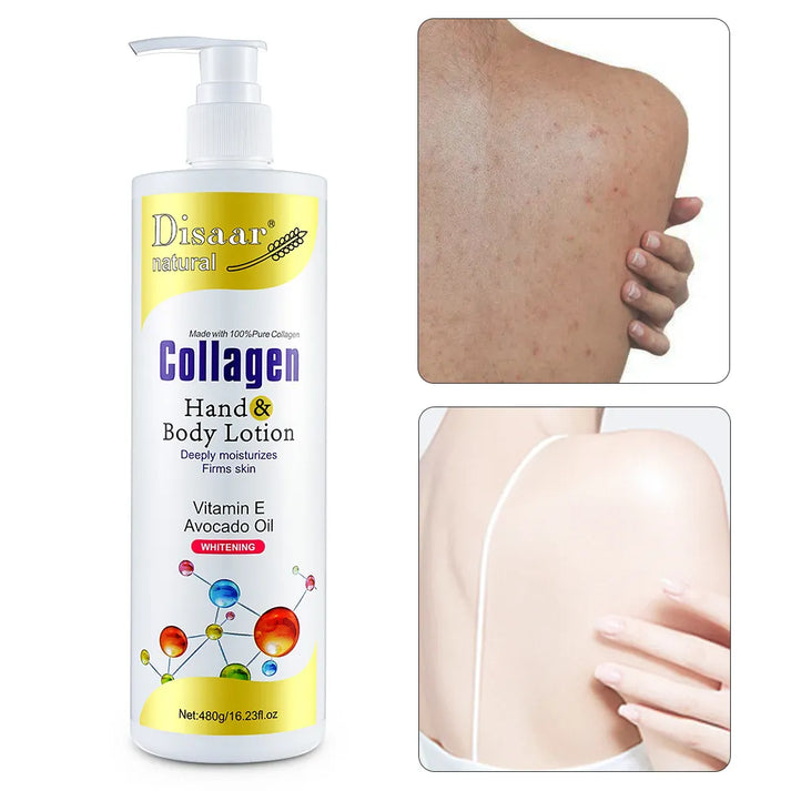 Collagen Hand Body Lotion Vitamin E Avocado Oil Deeply Moisturizes Firms Smooth Skin
