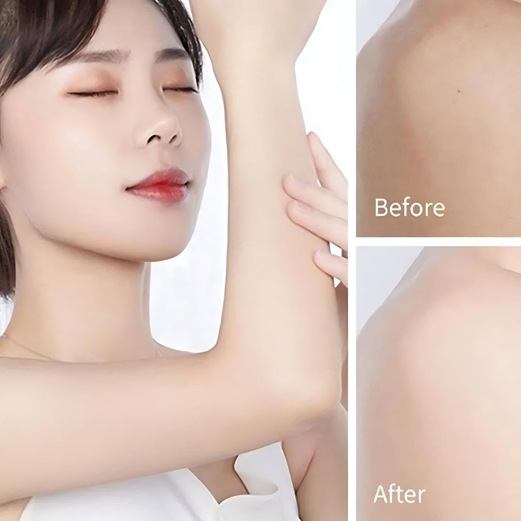 Buy 2 Hally + Free Delivery