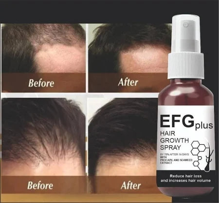 FEG Plus Hair Growth Serum